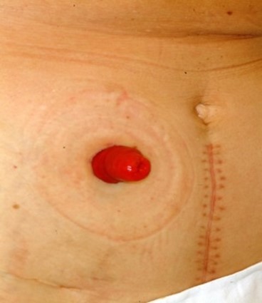 Et nærbilde av en persons hud med en rød blemme på