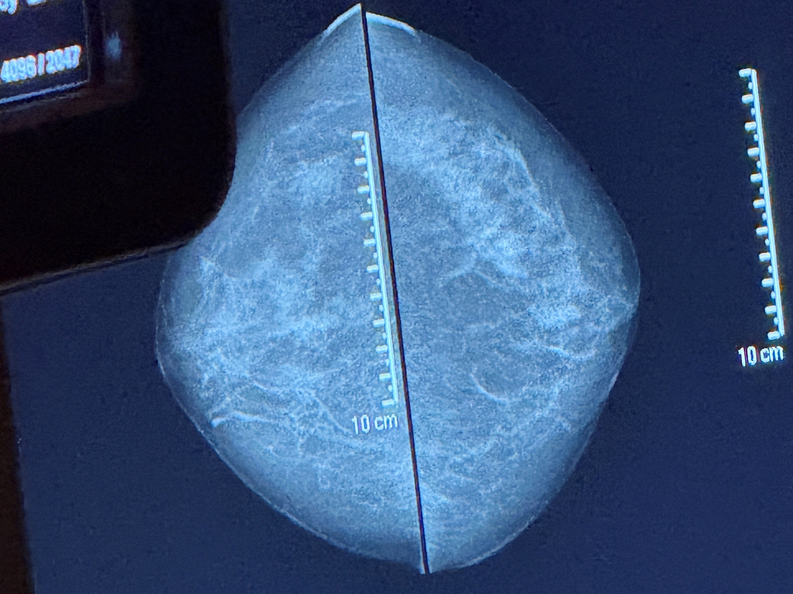 Et rundt objekt med blå bakgrunn