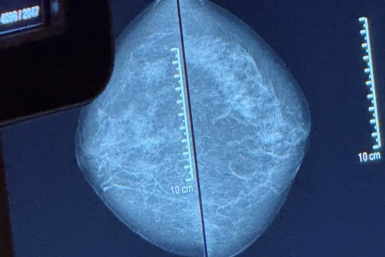 Et rundt objekt med blå bakgrunn